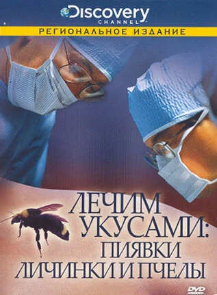 Постер Discovery: Лечим укусами. Пиявки, личинки и пчелы 2000