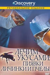 Discovery: Лечим укусами. Пиявки, личинки и пчелы 2000 постер
